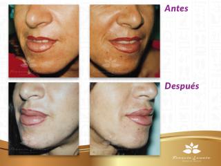 a01_002_labios_01